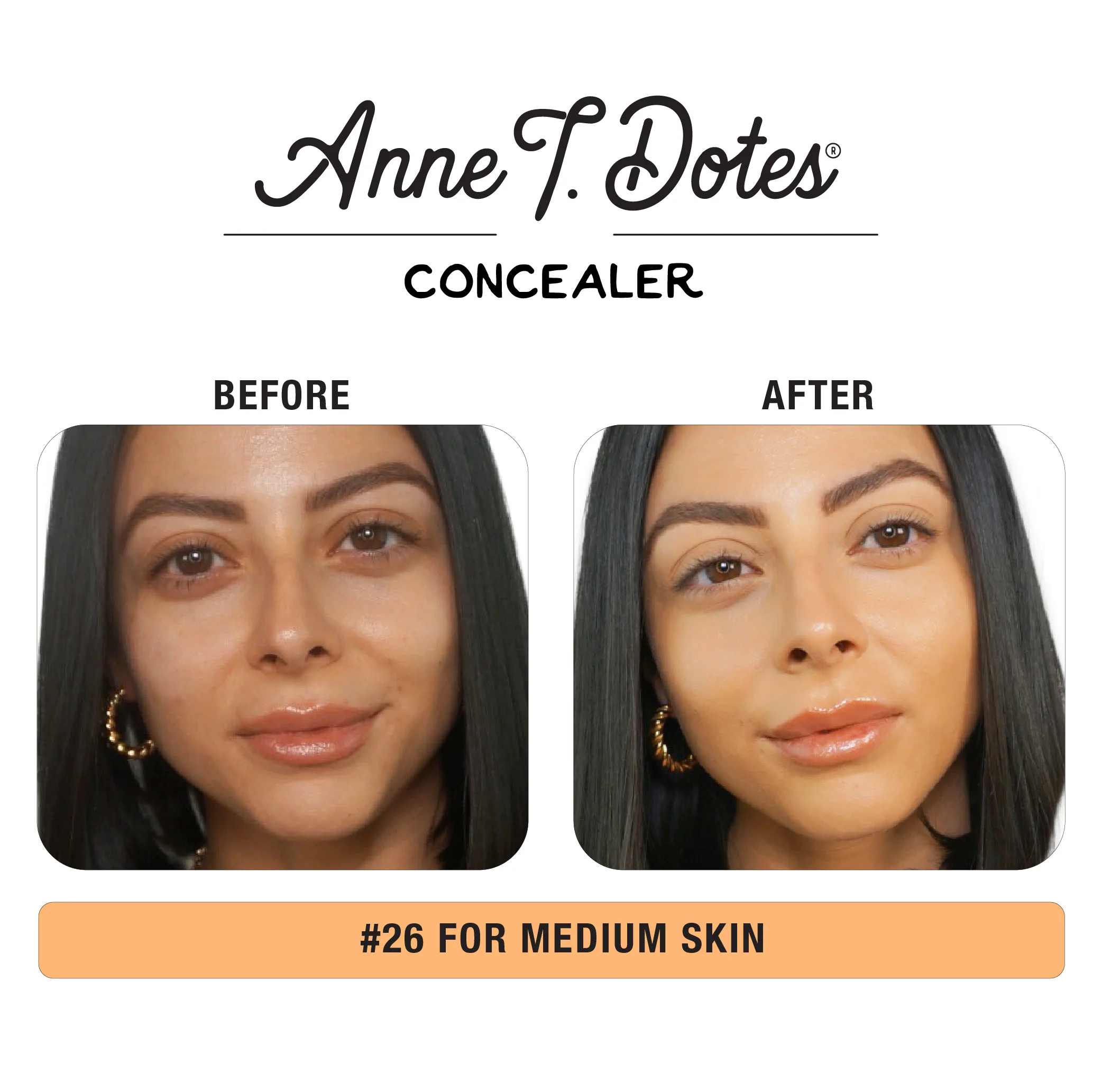 Anne T. Dotes® Pot Concealer - Image 19